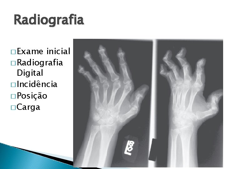 Radiografia � Exame inicial � Radiografia Digital � Incidência � Posição � Carga 