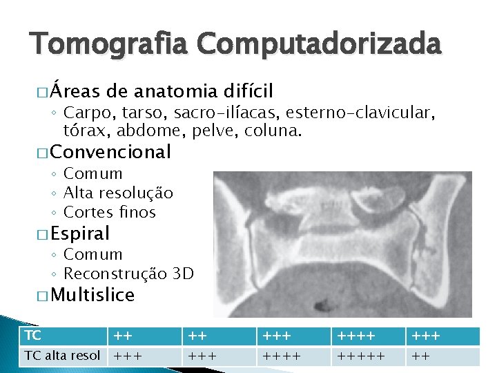 Tomografia Computadorizada � Áreas de anatomia difícil ◦ Carpo, tarso, sacro-ilíacas, esterno-clavicular, tórax, abdome,