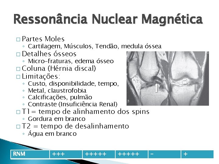 Ressonância Nuclear Magnética � Partes Moles ◦ Cartilagem, Músculos, Tendão, medula óssea � Detalhes