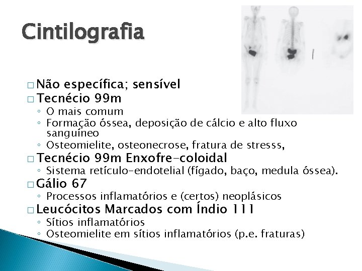 Cintilografia � Não específica; sensível � Tecnécio 99 m ◦ O mais comum ◦