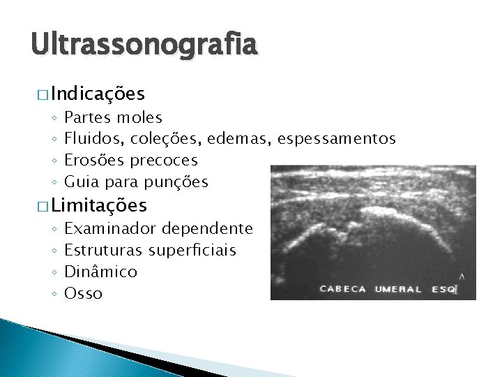 Ultrassonografia � Indicações ◦ ◦ Partes moles Fluidos, coleções, edemas, espessamentos Erosões precoces Guia