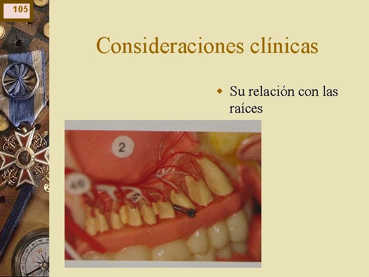 105 Consideraciones clínicas w Su relación con las raíces 105 Consideraciones clínicas w Su relación con las raíces