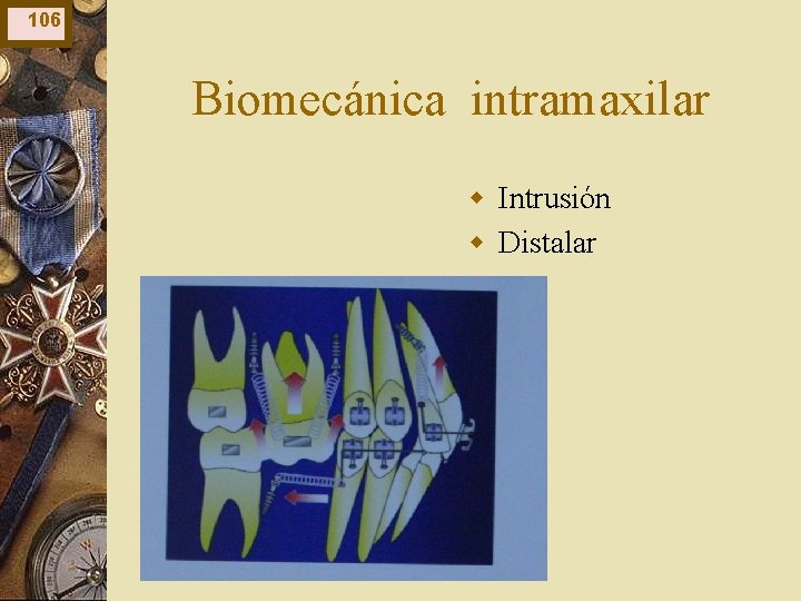 106 Biomecánica intramaxilar w Intrusión w Distalar 106 Biomecánica intramaxilar w Intrusión w Distalar