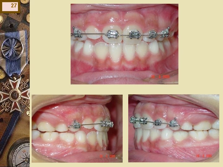 27 27