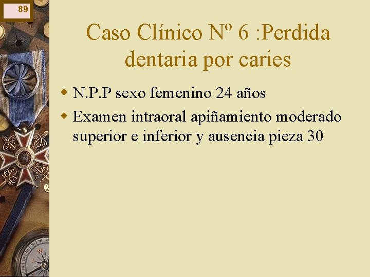 89 Caso Clínico Nº 6 : Perdida dentaria por caries w N. P. P 89 Caso Clínico Nº 6 : Perdida dentaria por caries w N. P. P