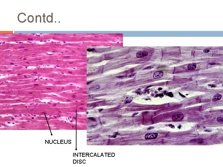 Contd. . NUCLEUS INTERCALATED DISC 