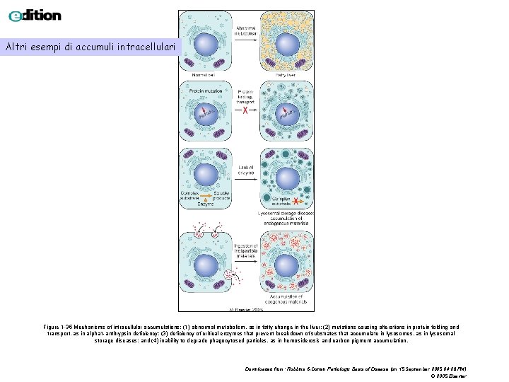 Altri esempi di accumuli intracellulari Figure 1 -35 Mechanisms of intracellular accumulations: (1) abnormal