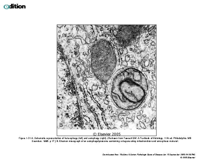 Figure 1 -31 A, Schematic representation of heterophagy (left) and autophagy (right). (Redrawn from