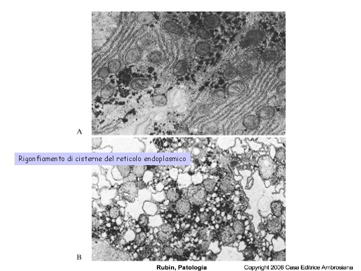 Rigonfiamento di cisterne del reticolo endoplasmico 