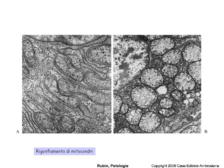 Rigonfiamento di mitocondri 