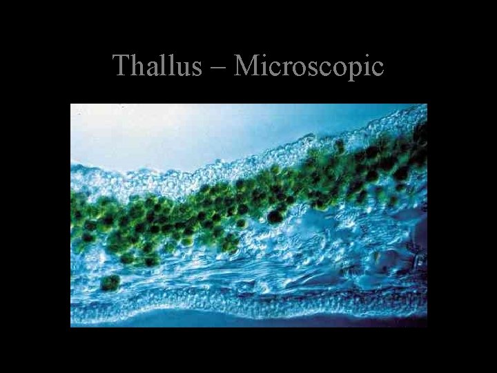 Thallus – Microscopic 