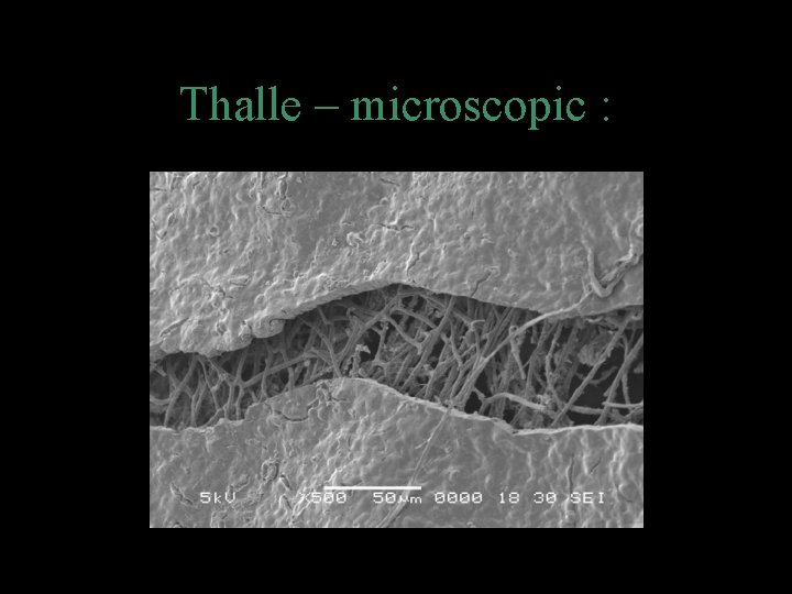 Thalle – microscopic : 