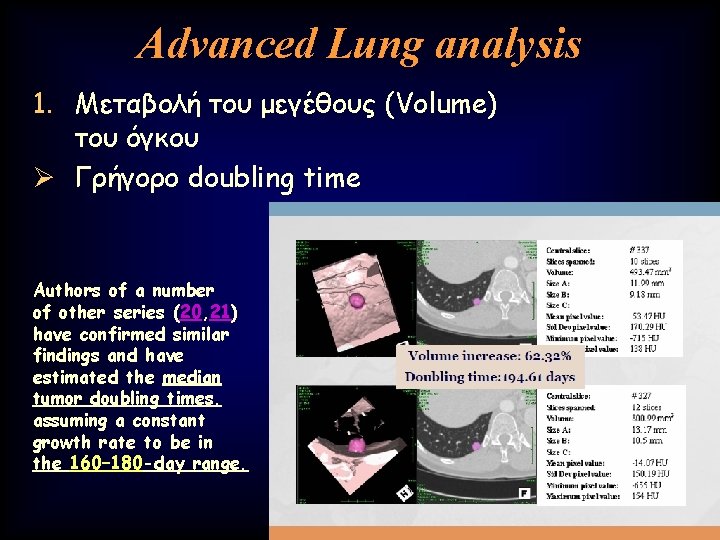 Advanced Lung analysis 1. Μεταβολή του μεγέθους (Volume) του όγκου Ø Γρήγορο doubling time