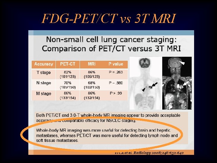 FDG-PET/CT vs 3 T MRI 