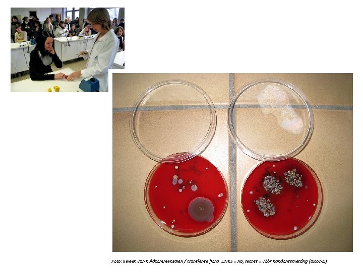 Foto: kweek van huidcommensalen / transiënte flora. LINKS = na, rechts = vóór handontsmetting