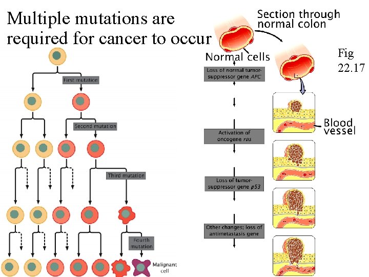 Multiple mutations are required for cancer to occur Fig 22. 17 