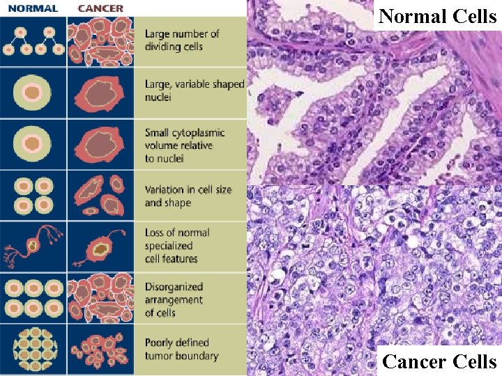 Normal Cells Cancer Cells 