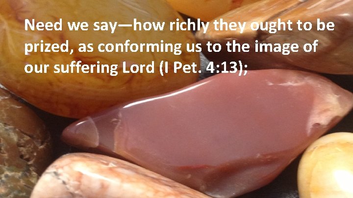 Need we say—how richly they ought to be prized, as conforming us to the