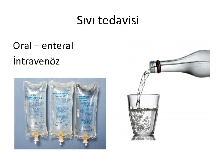 Sıvı tedavisi Oral – enteral İntravenöz 