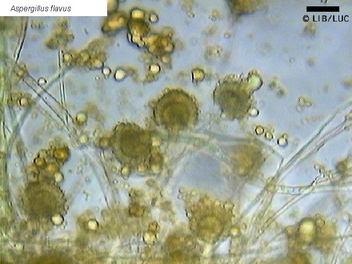 Aspergillus flavus 