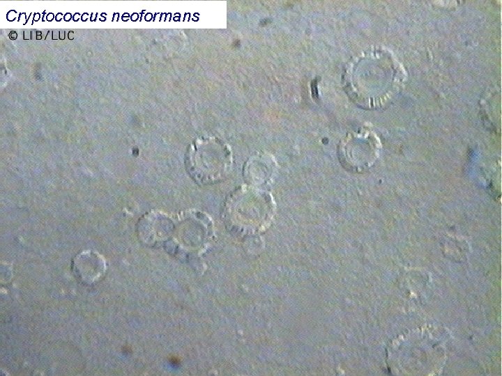 Cryptococcus neoformans 