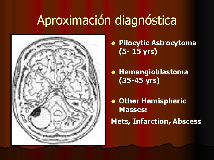 Aproximación diagnóstica l Pilocytic Astrocytoma (5 - 15 yrs) l Hemangioblastoma (35 -45 yrs) Aproximación diagnóstica l Pilocytic Astrocytoma (5 - 15 yrs) l Hemangioblastoma (35 -45 yrs)