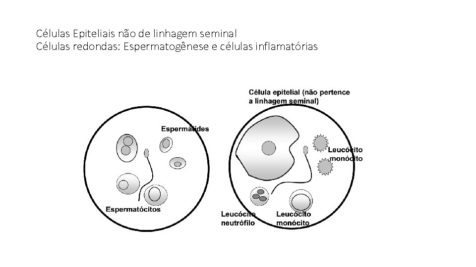 Células Epiteliais não de linhagem seminal Células redondas: Espermatogênese e células inflamatórias 