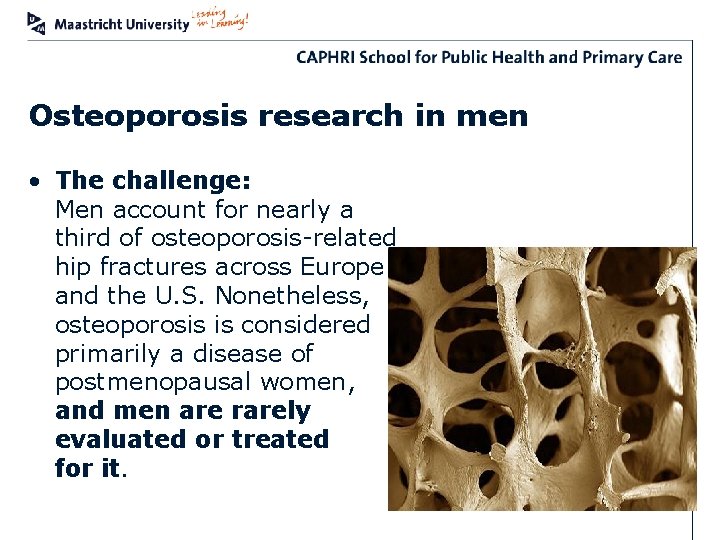 Osteoporosis research in men • The challenge: Men account for nearly a third of