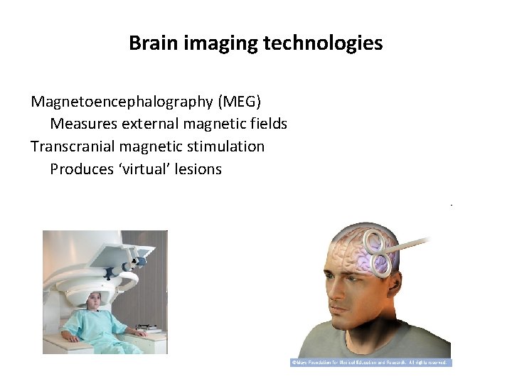 Brain imaging technologies Magnetoencephalography (MEG) Measures external magnetic fields Transcranial magnetic stimulation Produces ‘virtual’