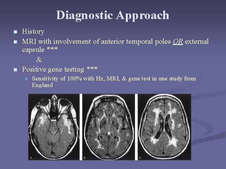 Diagnostic Approach n n n History MRI with involvement of anterior temporal poles OR