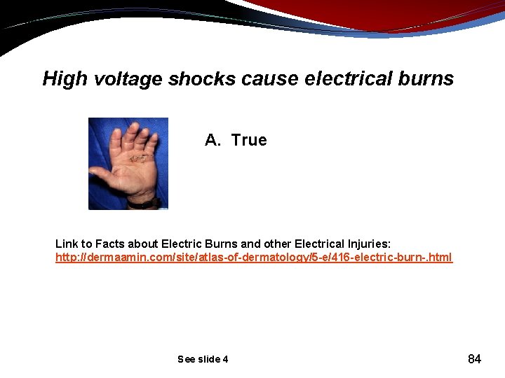 High voltage shocks cause electrical burns A. True Link to Facts about Electric Burns