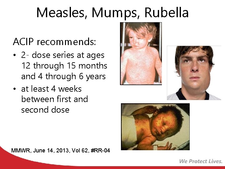 Measles, Mumps, Rubella ACIP recommends: • 2 - dose series at ages 12 through