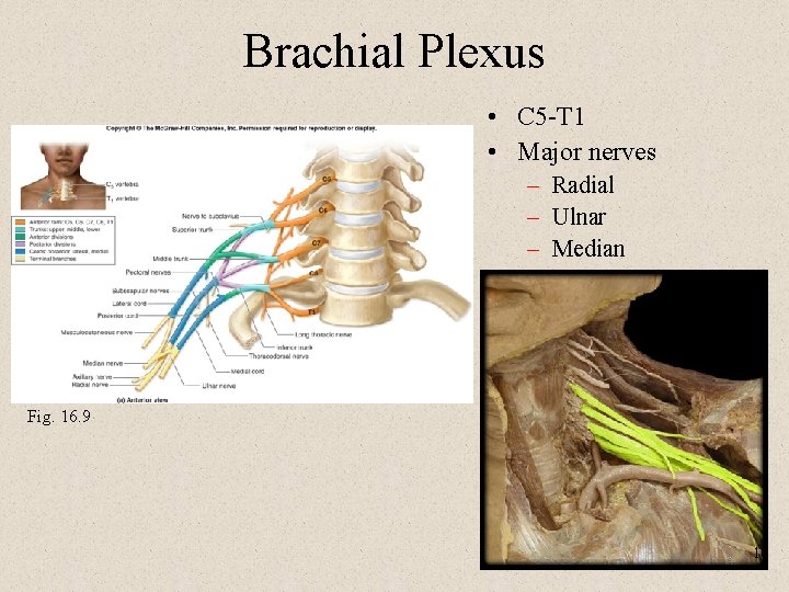 Brachial Plexus • C 5 -T 1 • Major nerves – Radial – Ulnar