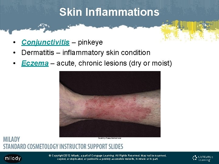 Skin Inflammations • Conjunctivitis – pinkeye • Dermatitis – inflammatory skin condition • Eczema