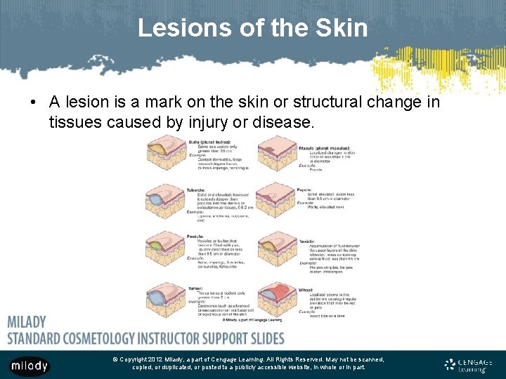 Lesions of the Skin • A lesion is a mark on the skin or