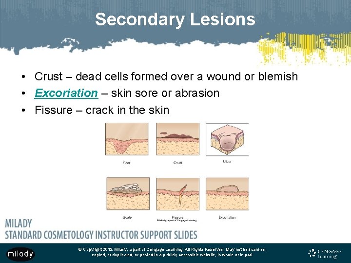 Secondary Lesions • Crust – dead cells formed over a wound or blemish •