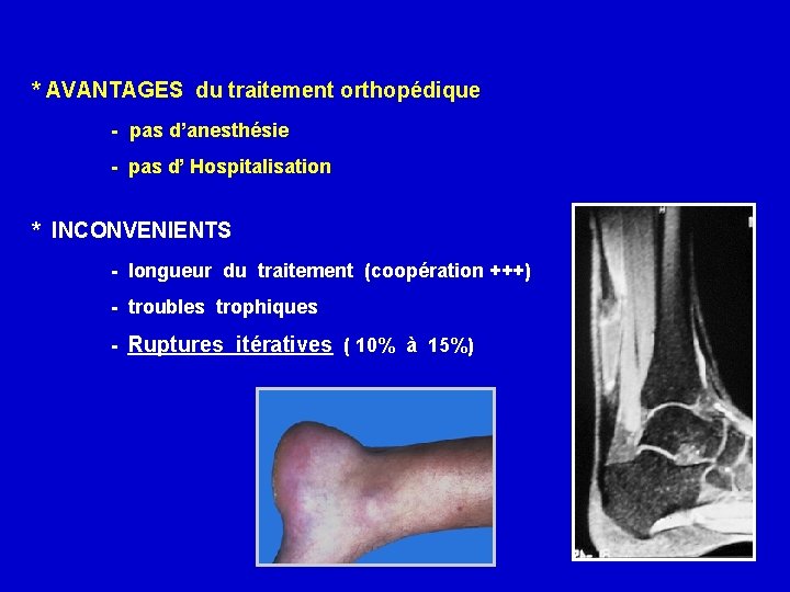 * AVANTAGES du traitement orthopédique - pas d’anesthésie - pas d’ Hospitalisation * INCONVENIENTS
