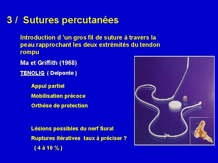 3 / Sutures percutanées Introduction d ’un gros fil de suture à travers la