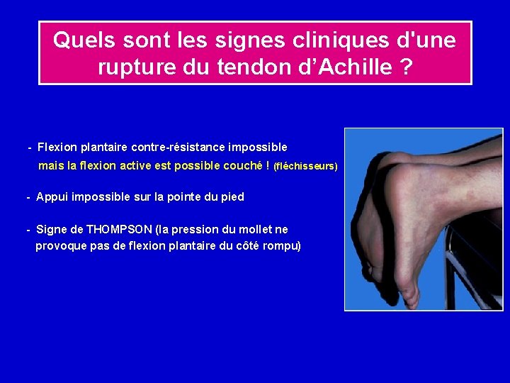 Quels sont les signes cliniques d'une rupture du tendon d’Achille ? - Flexion plantaire