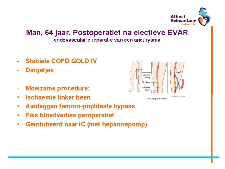 Man, 64 jaar. Postoperatief na electieve EVAR endovasculaire reparatie van een aneurysma - Stabiele