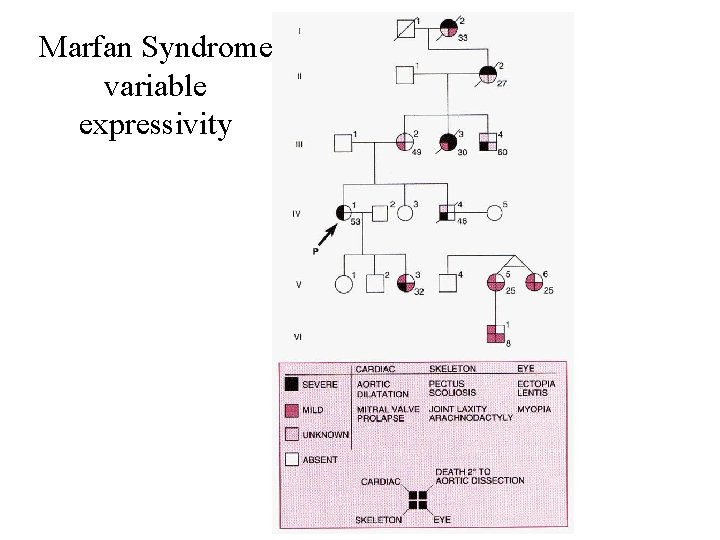 Marfan Syndrome variable expressivity 