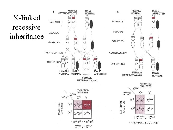 X-linked recessive inheritance 