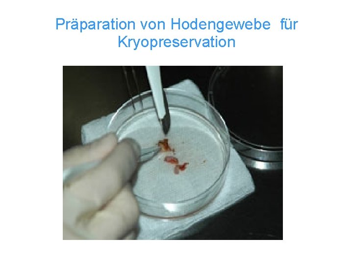 Präparation von Hodengewebe für Kryopreservation 