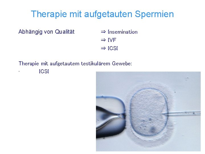 Therapie mit aufgetauten Spermien Abhängig von Qualität ⇒ Insemination ⇒ IVF ⇒ ICSI Therapie