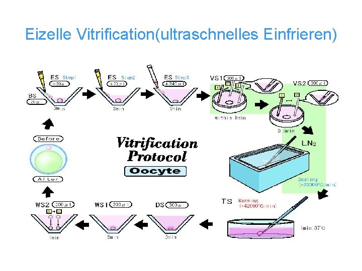 Eizelle Vitrification(ultraschnelles Einfrieren) 