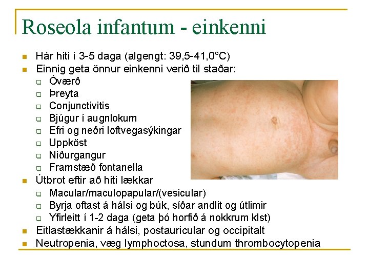 Roseola infantum - einkenni n n n Hár hiti í 3 -5 daga (algengt: