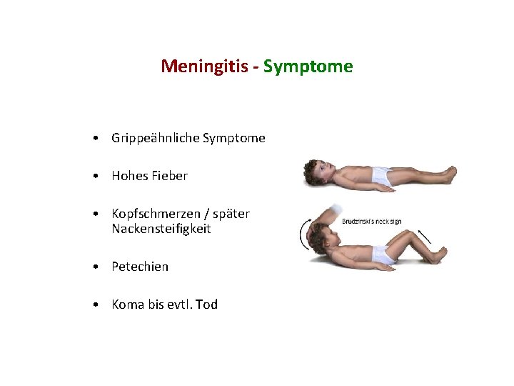 Meningitis - Symptome • Grippeähnliche Symptome • Hohes Fieber • Kopfschmerzen / später Nackensteifigkeit