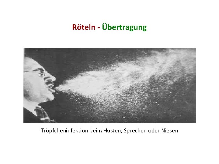 Röteln - Übertragung Tröpfcheninfektion beim Husten, Sprechen oder Niesen 