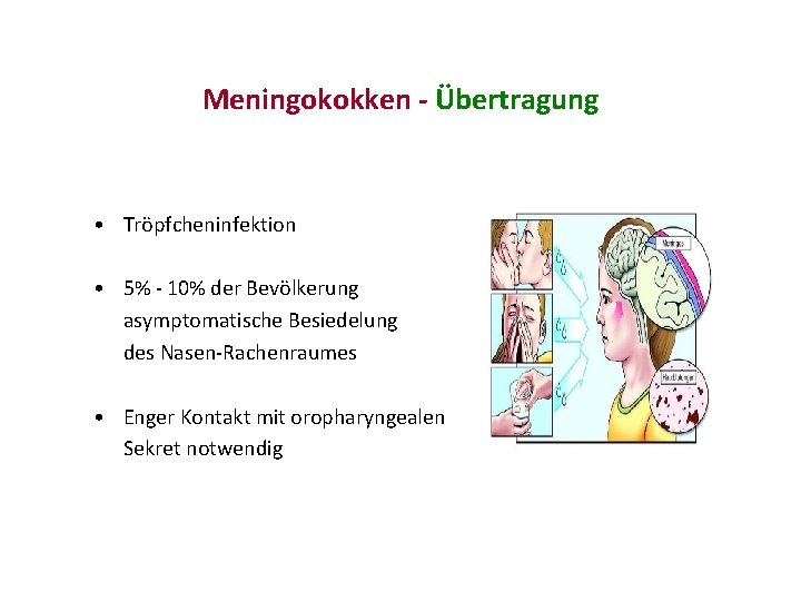 Meningokokken - Übertragung • Tröpfcheninfektion • 5% - 10% der Bevölkerung asymptomatische Besiedelung des