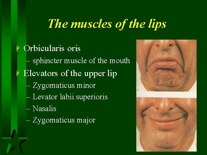 The muscles of the lips H Orbicularis oris – sphincter muscle of the mouth